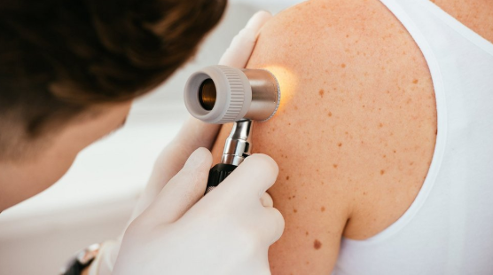 Wie Hautkrebsvorsorge Ihnen hilft, gefährliche Hautveränderungen rechtzeitig zu erkennen
